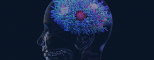 Fanciful image of a brain in a skull