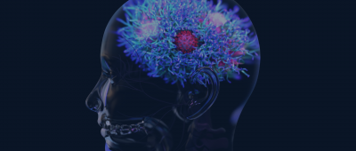 Fanciful image of a brain in a skull